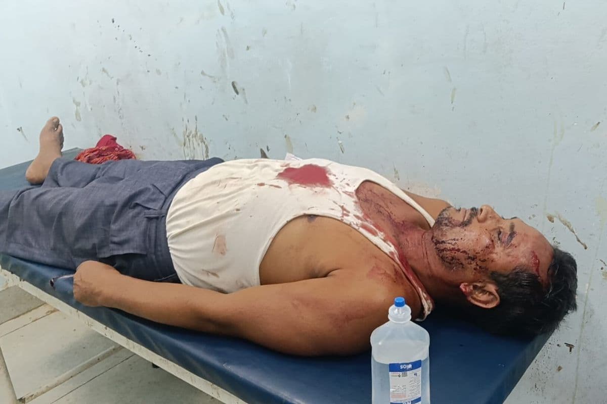 गोपालगंज: बेटे को घेरने के बाद पिता पर किया गया हमला