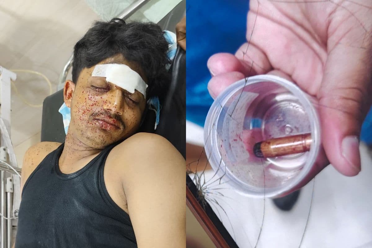 कोढ़ा के संदलपुर में देर रात ताबड़तोड़ गोलीबारी, युवक के सिर में लगी गोली, पांच संदिग्ध हिरासत में