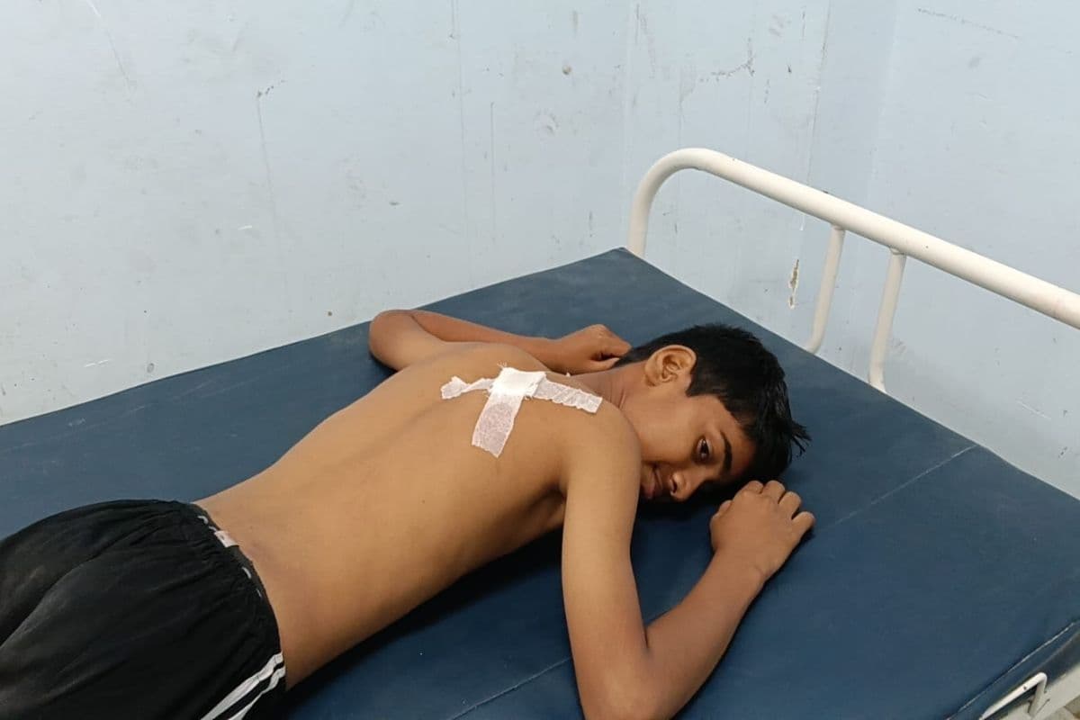 Gopalganj News : फुटबॉल खेल के दौरान विवाद, 12 वर्षीय बच्चे पर चाकू से हमला, हालत गंभीर