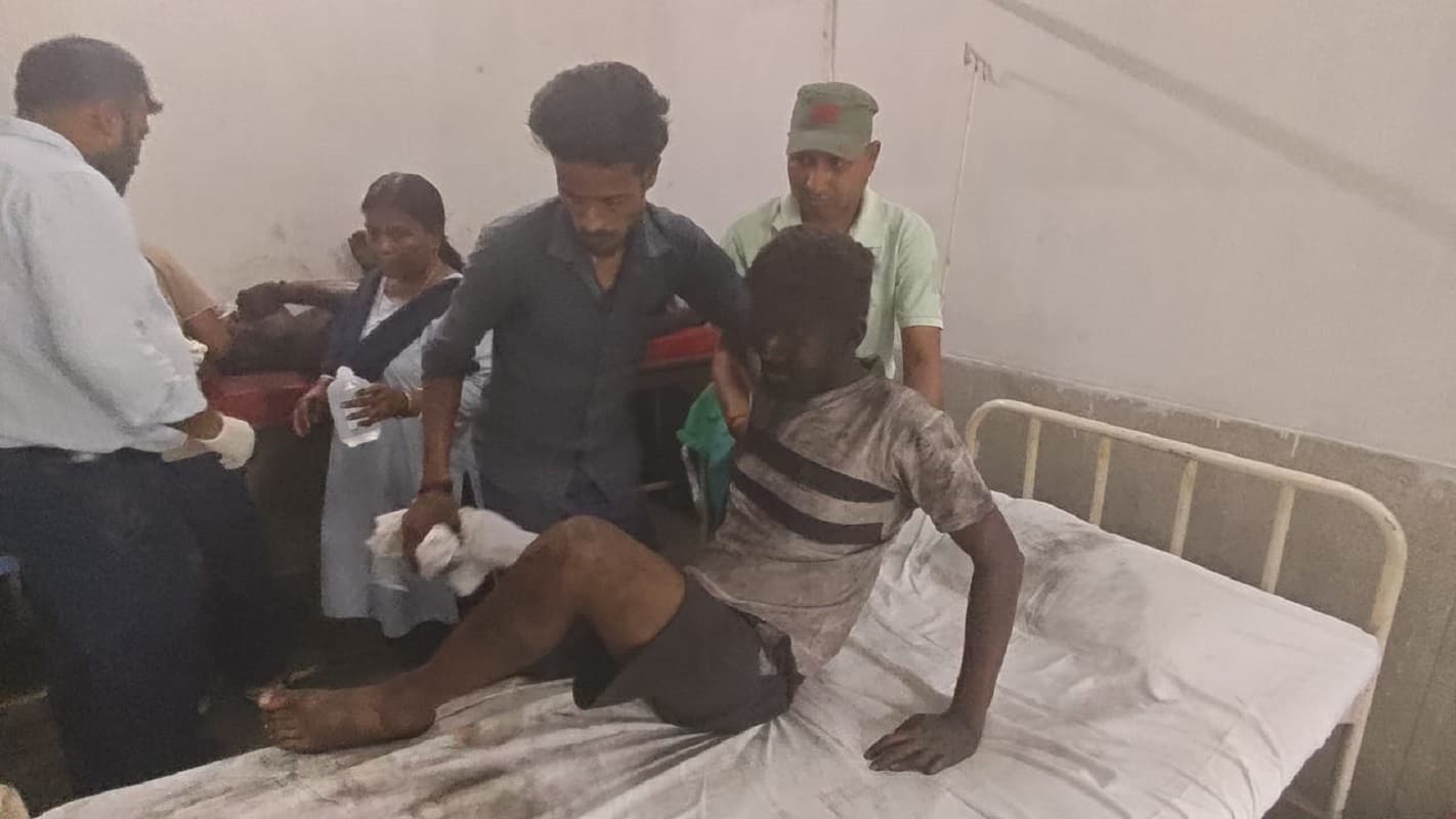 बंगाल के कोयला खदान में भीषण विस्फोट, 40 से अधिक मजदूर घायल, एक की मौत की