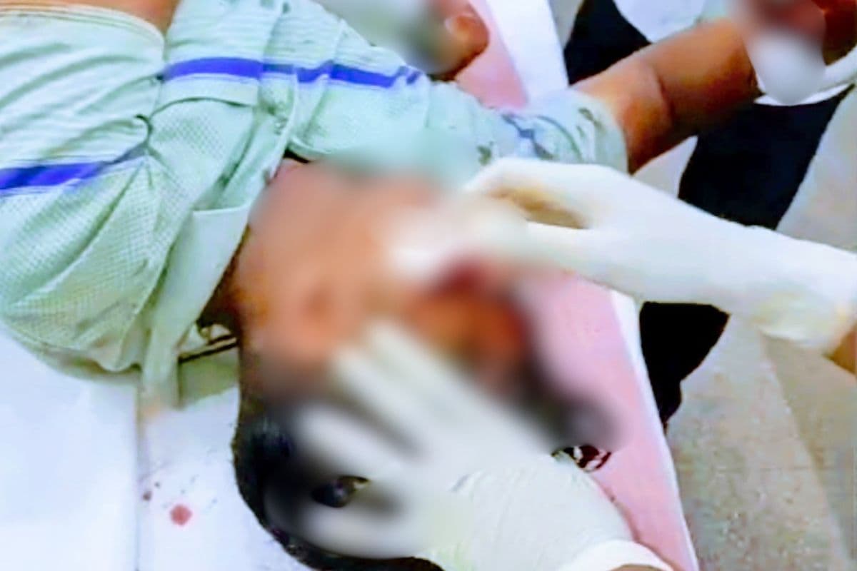 नो एंट्री में खड़े ट्रक से बाइक टकराई, BHG जवान गंभीर रूप से घायल