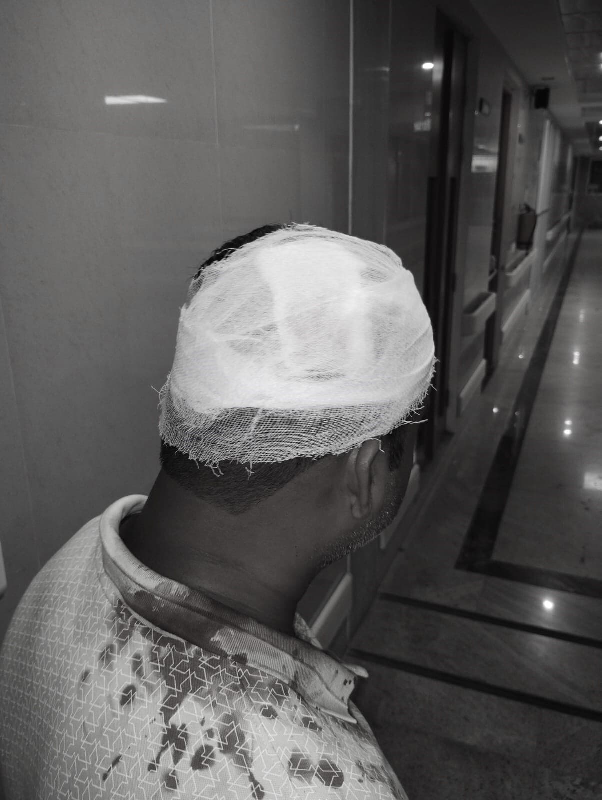 Jamshedpur News : मानगो : घर के सामने नशापान से रोका, तो इंजीनियर की कर दी पिटाई