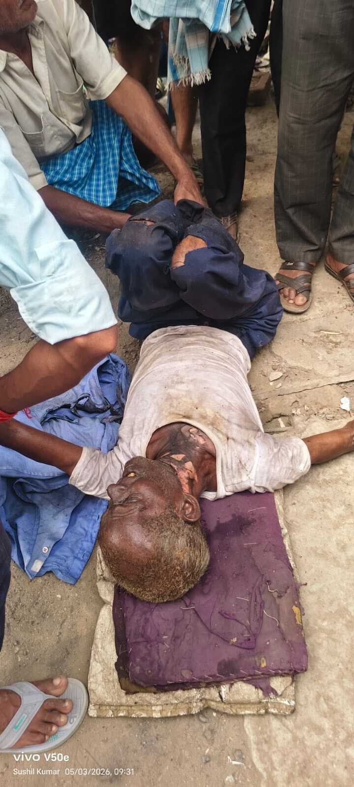 लोहे का ड्रम काटने के दौरान धमाका, मिस्त्री गंभीर रूप से घायल