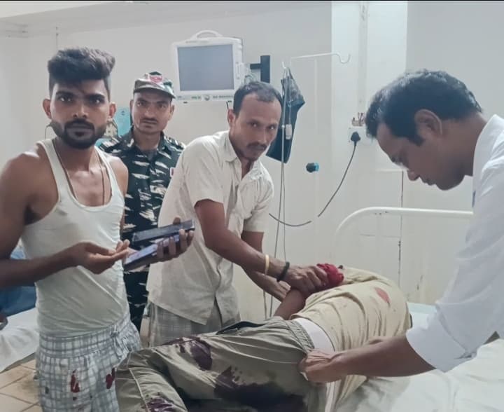 BANKA NEWS गैस ब्लास्ट होने से युवक जख्मी, स्थिती गंभीर, रेफर