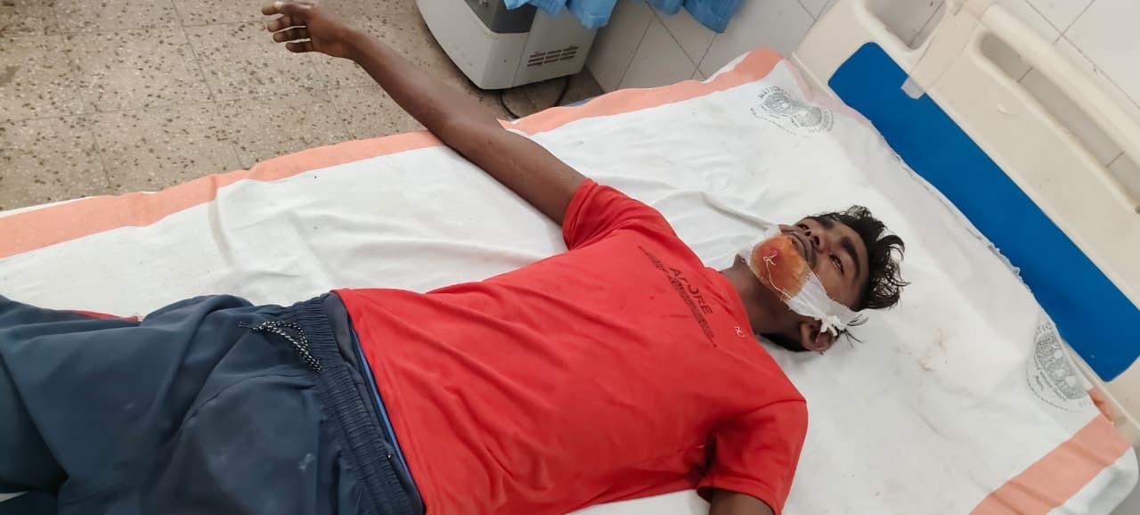 बीडी गांव में दो पक्षों में जमकर मारपीट, सगे भाइयों सहित तीन घायल
