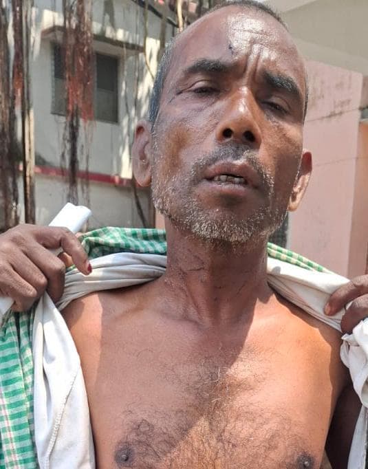 Purnia, शराब के नशे में बेटे ने पिता को पीटा, गला दबाया, जान बचा पहुंचे जीएमसीएच