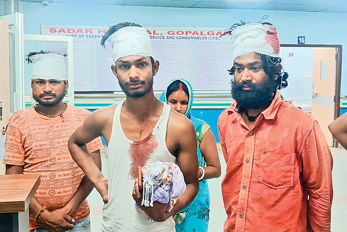 Gopalganj News : बैकुंठपुर में कथा मटकोर में गाना बजाने को लेकर दो पक्षों में मारपीट, 11 लोग घायल