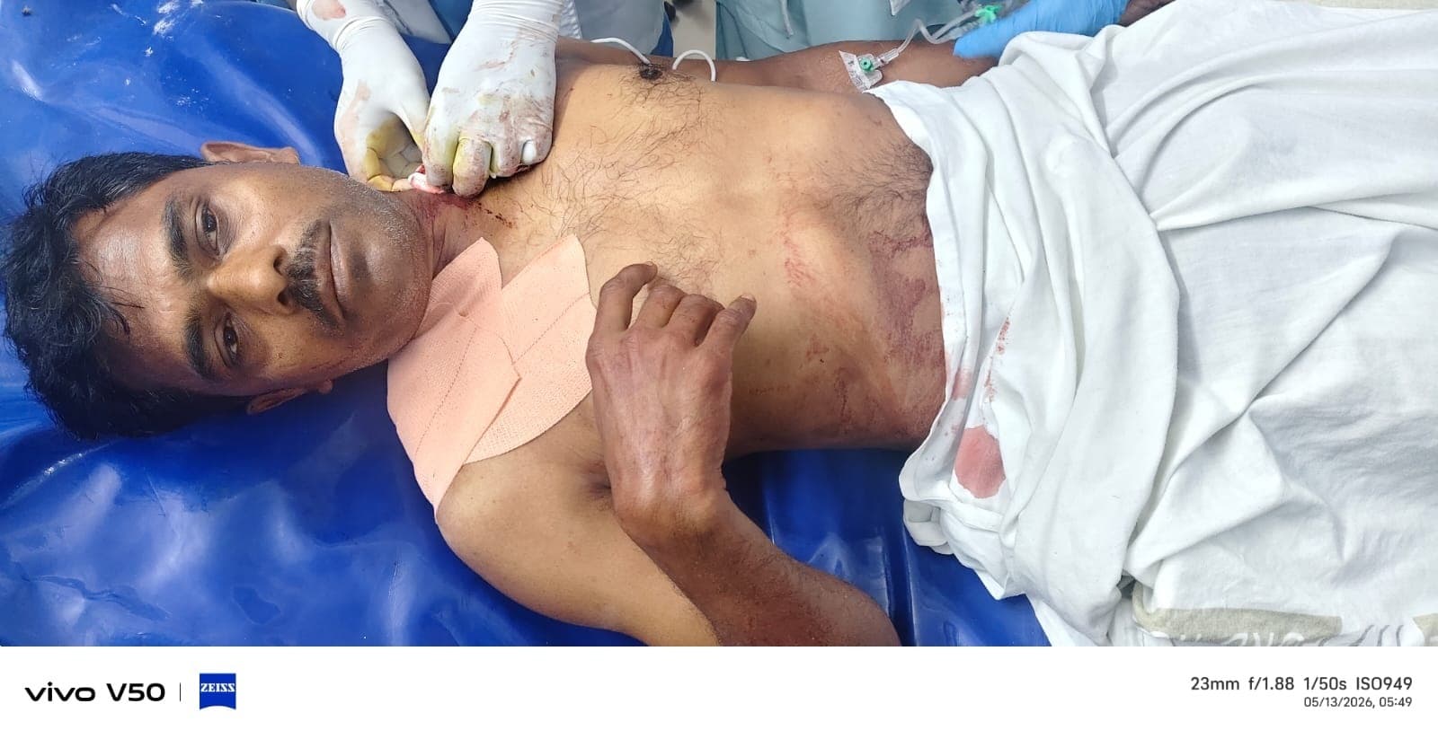 मोबाइल छीनने के विरोध पर शिक्षक को मारी गोली