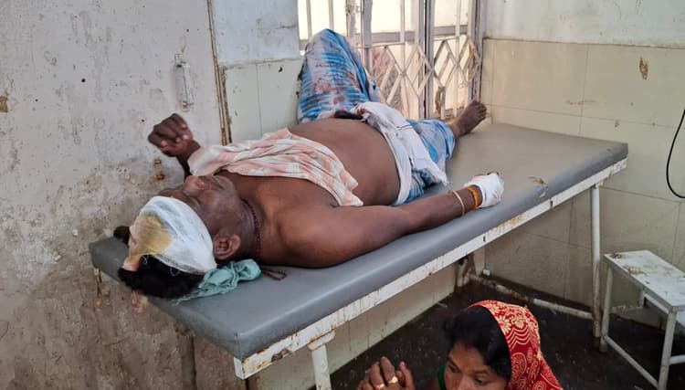 मजदूरी के पैसे मांगने पर मजदूर के सिर पर रॉड से हमला,  हालत नाजुक