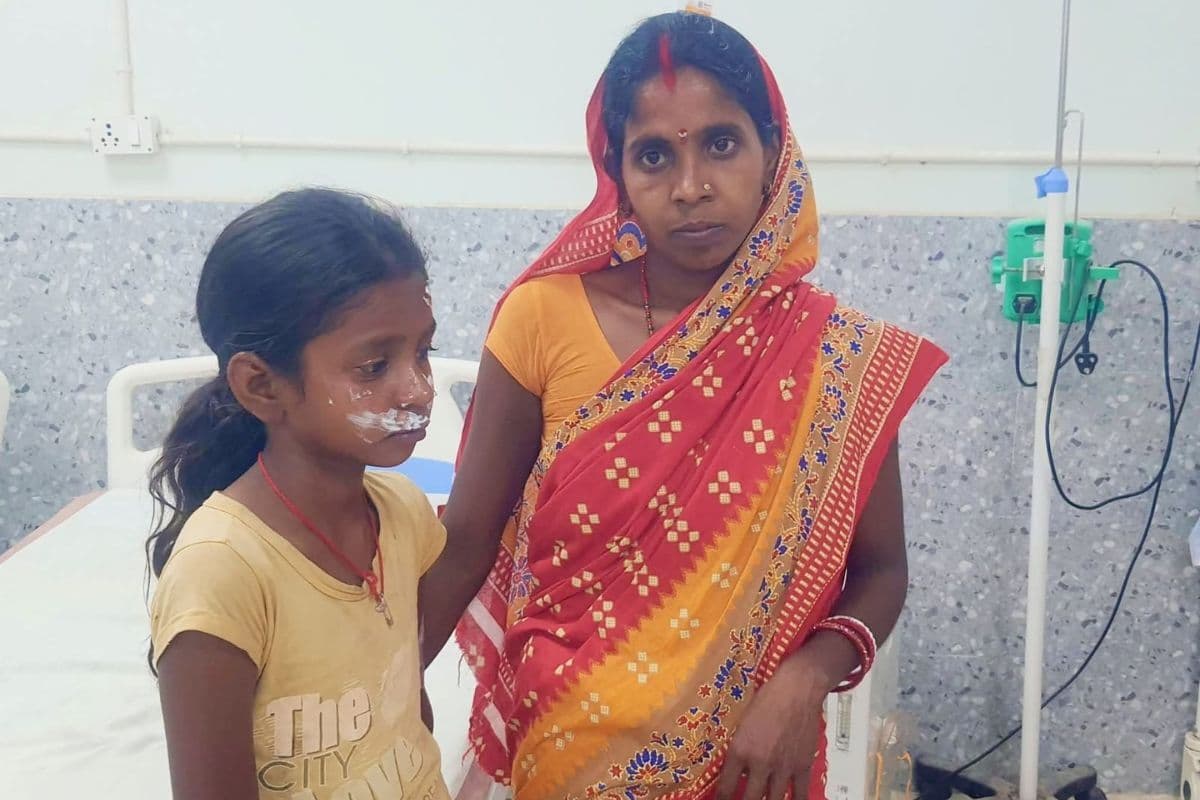 खौलती सब्जी चेहरे पर गिरने से 13 वर्षीय किशोरी झुलसी