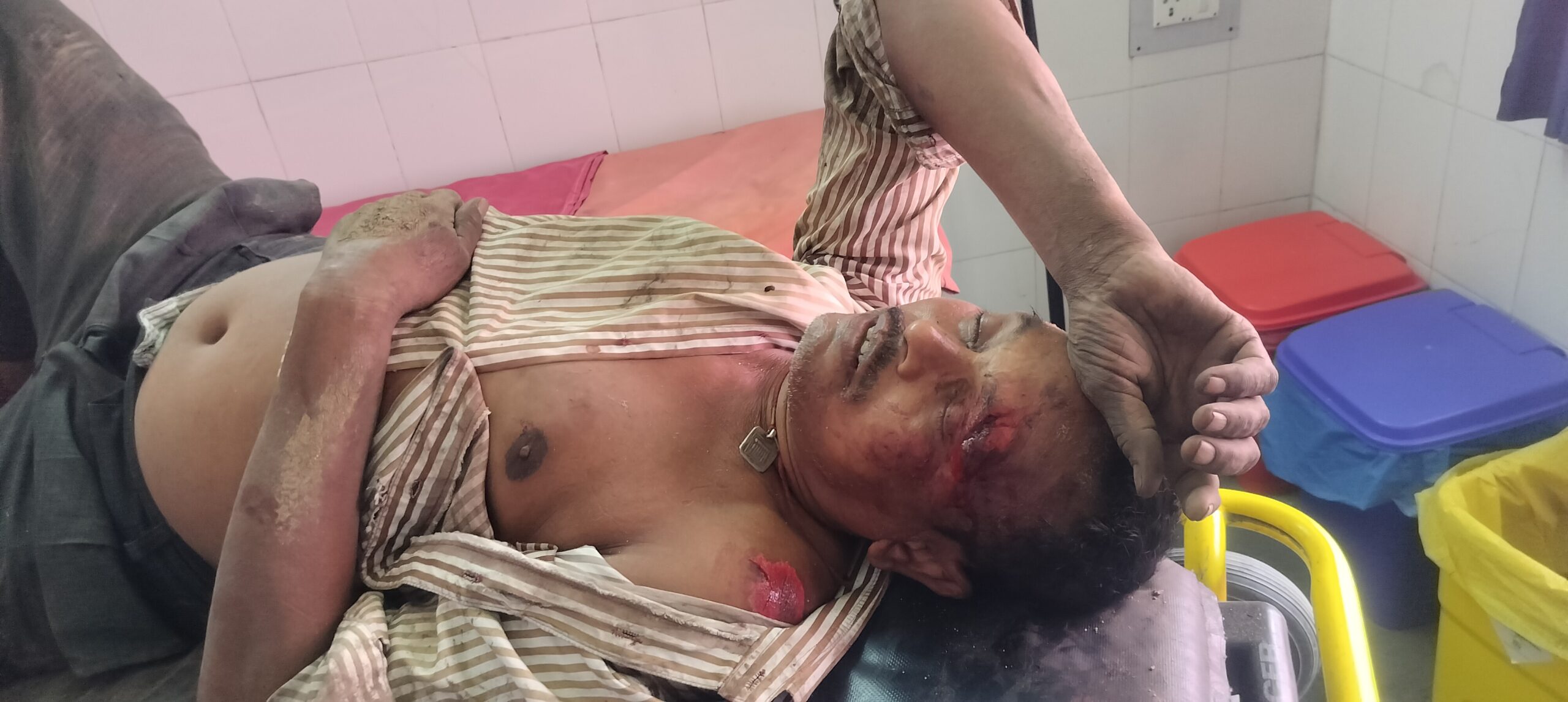 कपाली जंगल में फेरीवाले की हत्या कर शव जलाया, तीन दिनों से लापता था