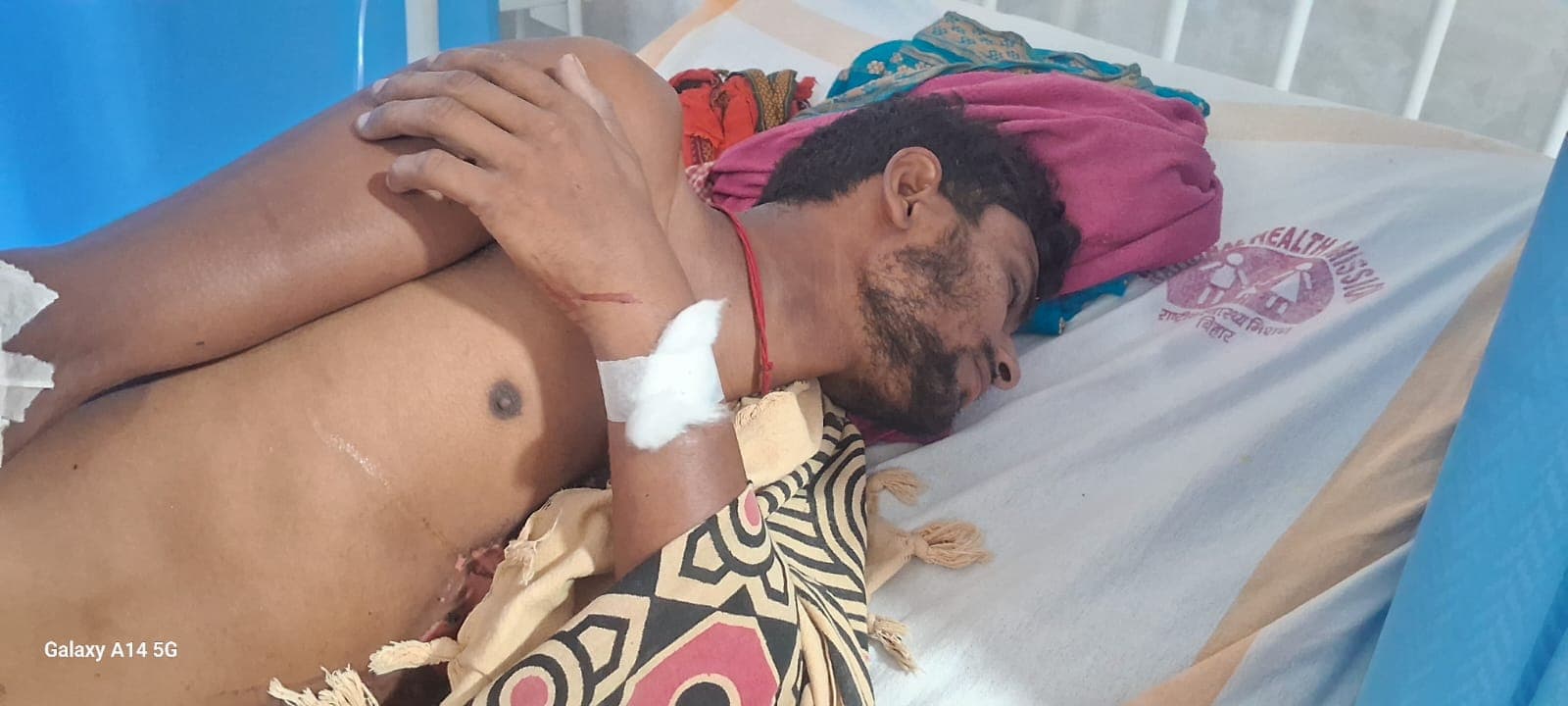 वज्रपात की चपेट में आने से एक युवक जख्मी, रेफर
