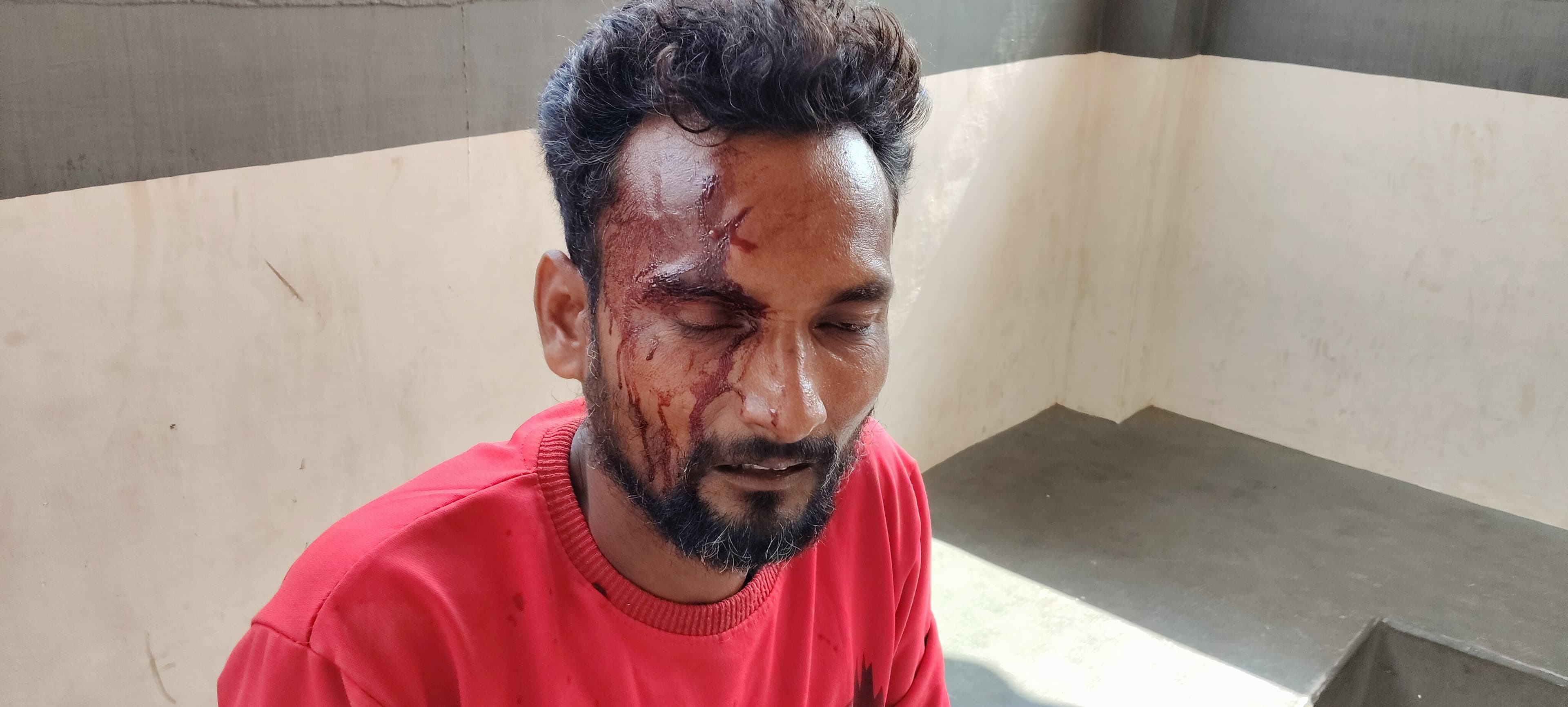 बुच्ची गांव में रास्ता विवाद को लेकर मारपीट, युवक घायल