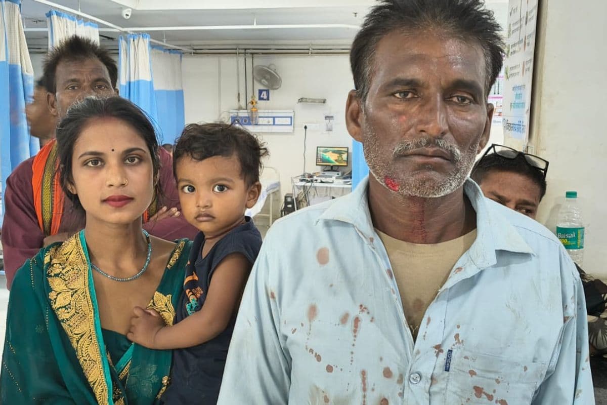 तीन लाख रुपये नहीं मिलने पर दामाद बना हैवान, ससुर का गाल दांत से काटा