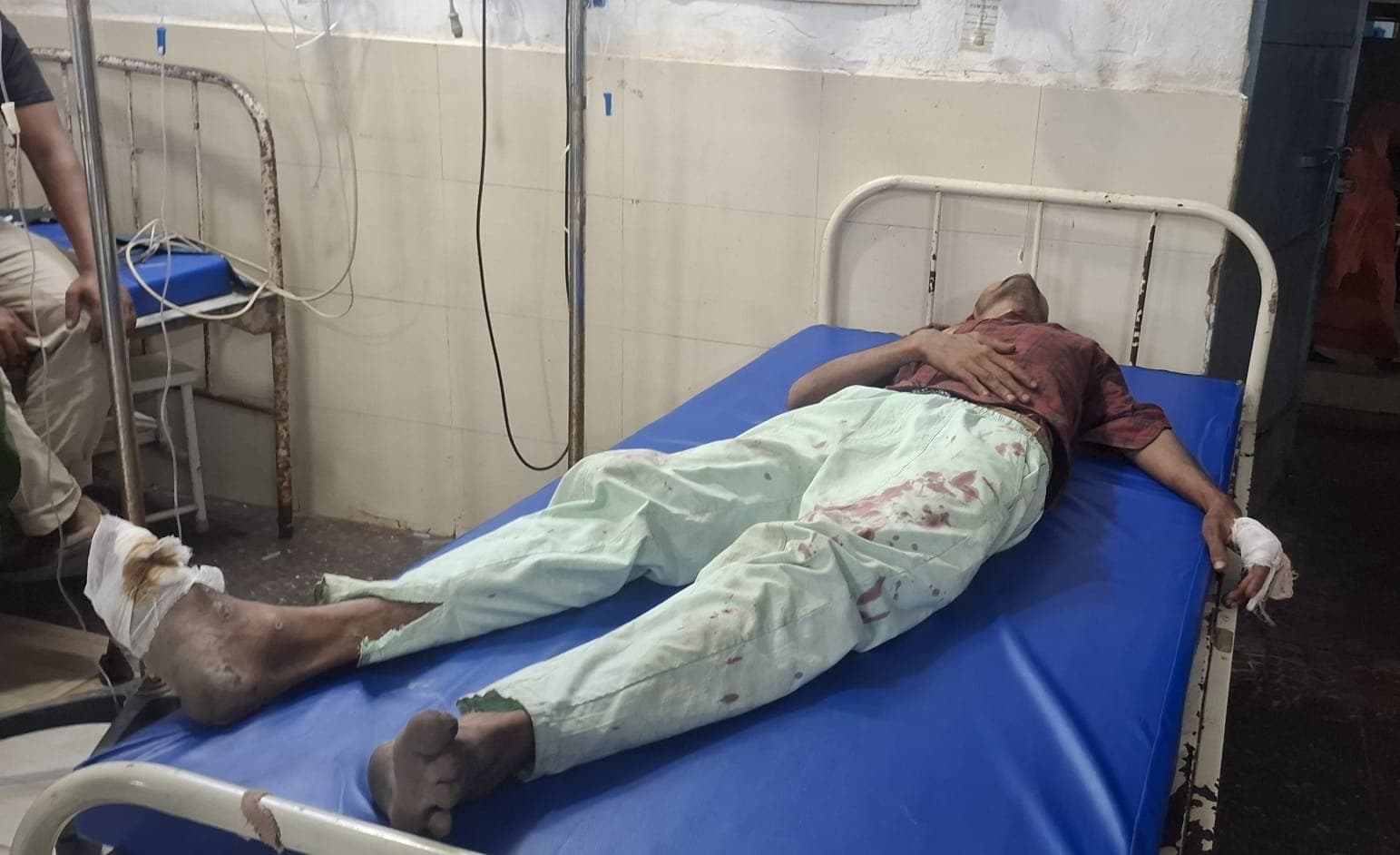 Purniya News : पूर्णिया लाइन बाजार में बाइक चोरी करते रंगे हाथ पकड़ा गया युवक, भीड़ ने की पिटाई, पुलिस ने बचाकर अस्पताल पहुंचाया