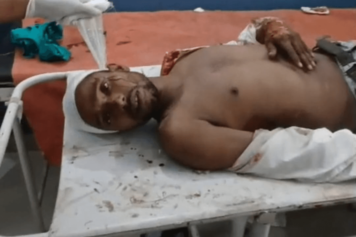 बेगूसराय में दो बाइकों की आमने-सामने की टक्कर में पांच घायल, चार की हालत गंभीर, सदर अस्पताल रेफर