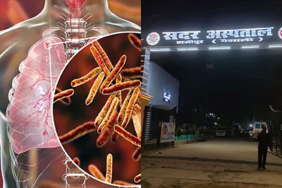 टीबी मुक्त भारत अभियान: वैशाली में 100 दिवसीय अभियान की रफ्तार धीमी, लक्ष्य का सिर्फ 22% पंजीकरण