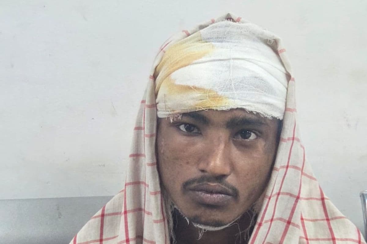 मधेपुरा में सिंहेश्वर जाने के दौरान युवक की बाइक हुई अनियंत्रित, सिर में गंभीर चोट