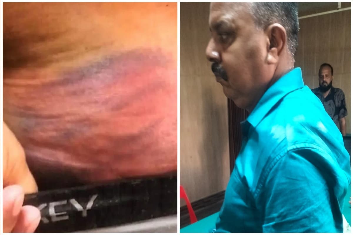 पुलिस रिमांड में रामपुर गोलीकांड के आरोपी की बेरहमी से पिटाई, मेडिकल रिपोर्ट में शरीर पर चोट के निशान की पुष्टि
