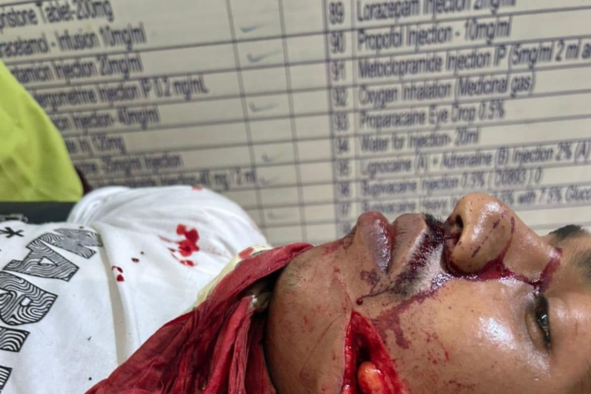 नवगछिया में ताजिया जुलूस के दौरान तलवारबाजी में दो युवक घायल, मायागंज रेफर