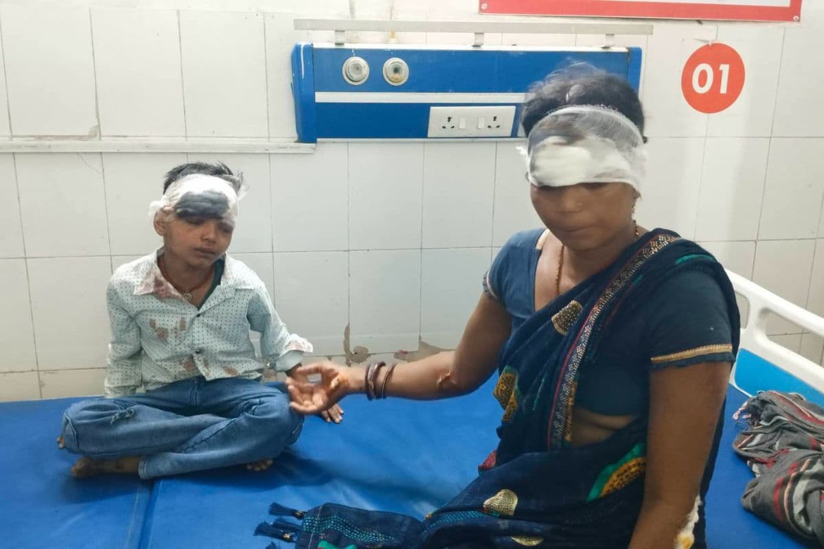 तेज रफ्तार स्कॉर्पियो ने बाइक को रौंदा, दंपती व मासूम बच्चा तीनों घायल, पूर्णिया GMCH रेफर