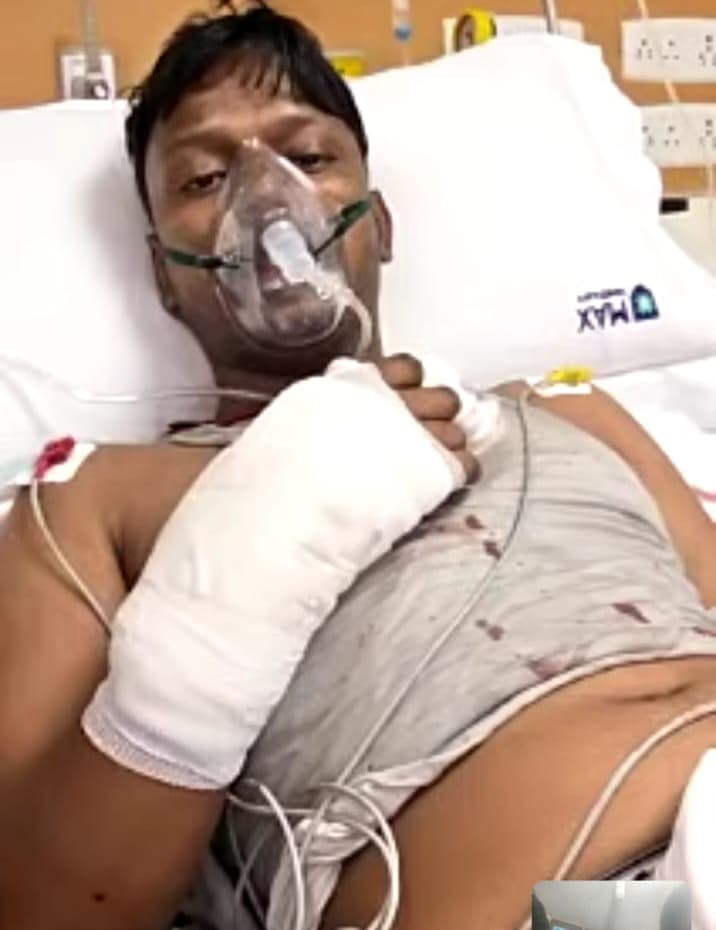 दिल्ली होटल हादसा के घायलों में शामिल  पूर्णिया के युवक ने खिड़की से कूदकर बचायी थी जान