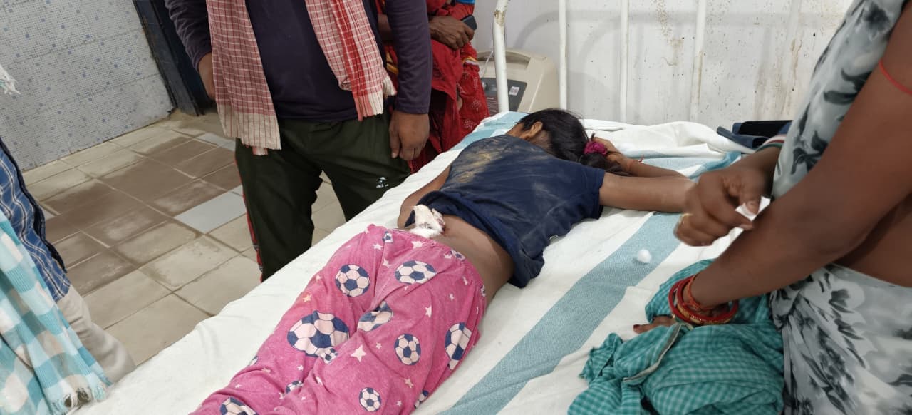 कटखने बंदर के हमले से किशोरी हुई जख्मी