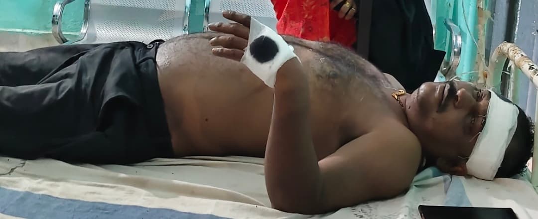 भवानीपुर में मुखिया पति पर गोलीबारी, हथियार के बट से मार किया घायल, 32 हजार लूटे