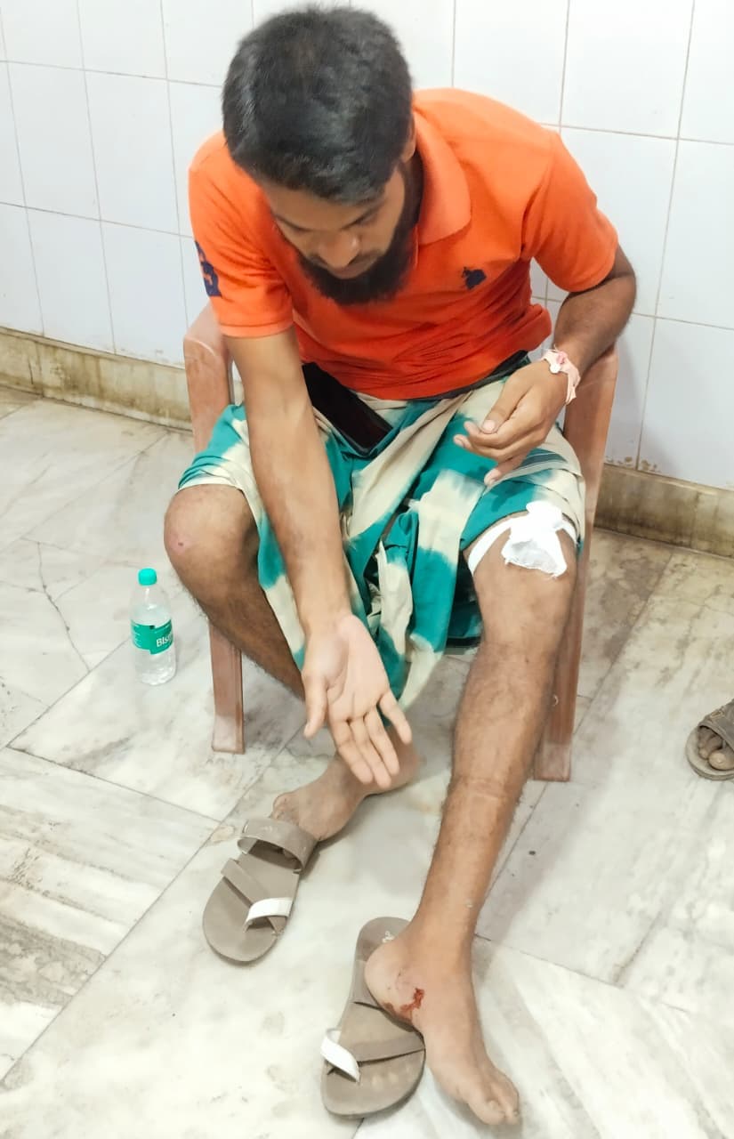 अमदाबाद में पाइप बिछाने के दौरान सांप ने युवक को डसा