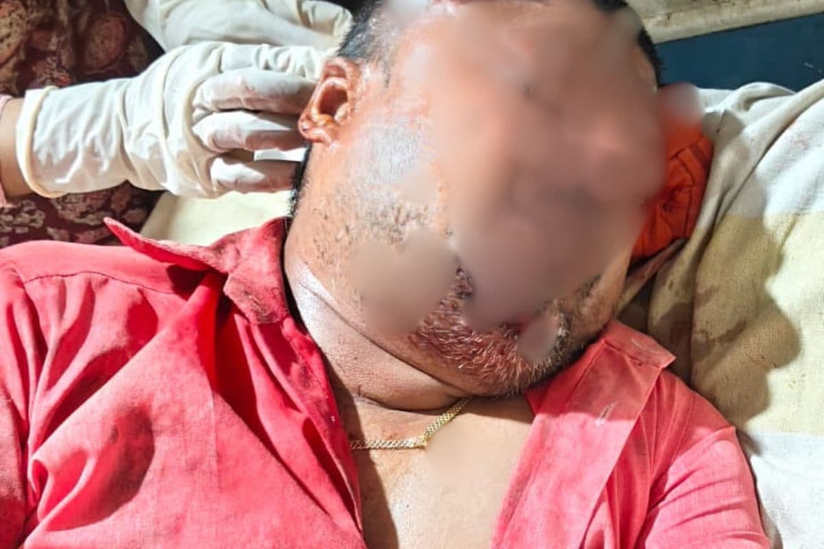 गयाजी के मंझौली बाजार में खूनी संघर्ष: आपस में भिड़े दो दुकानदार, एक-दूसरे को पीटकर किया लहूलुहान