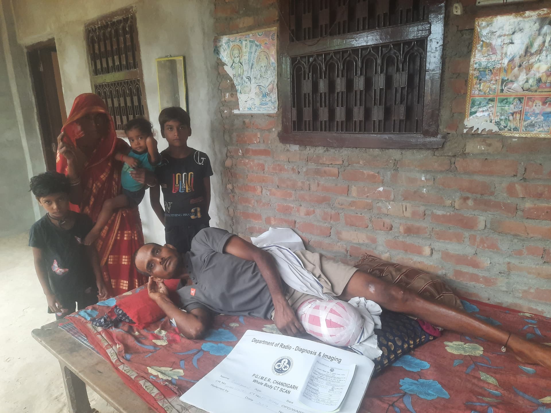 पंजाब कमाने गया था, गांव लौटा तो एक पैर नहीं था... दरभंगा के मजदूर की दर्दनाक कहानी
