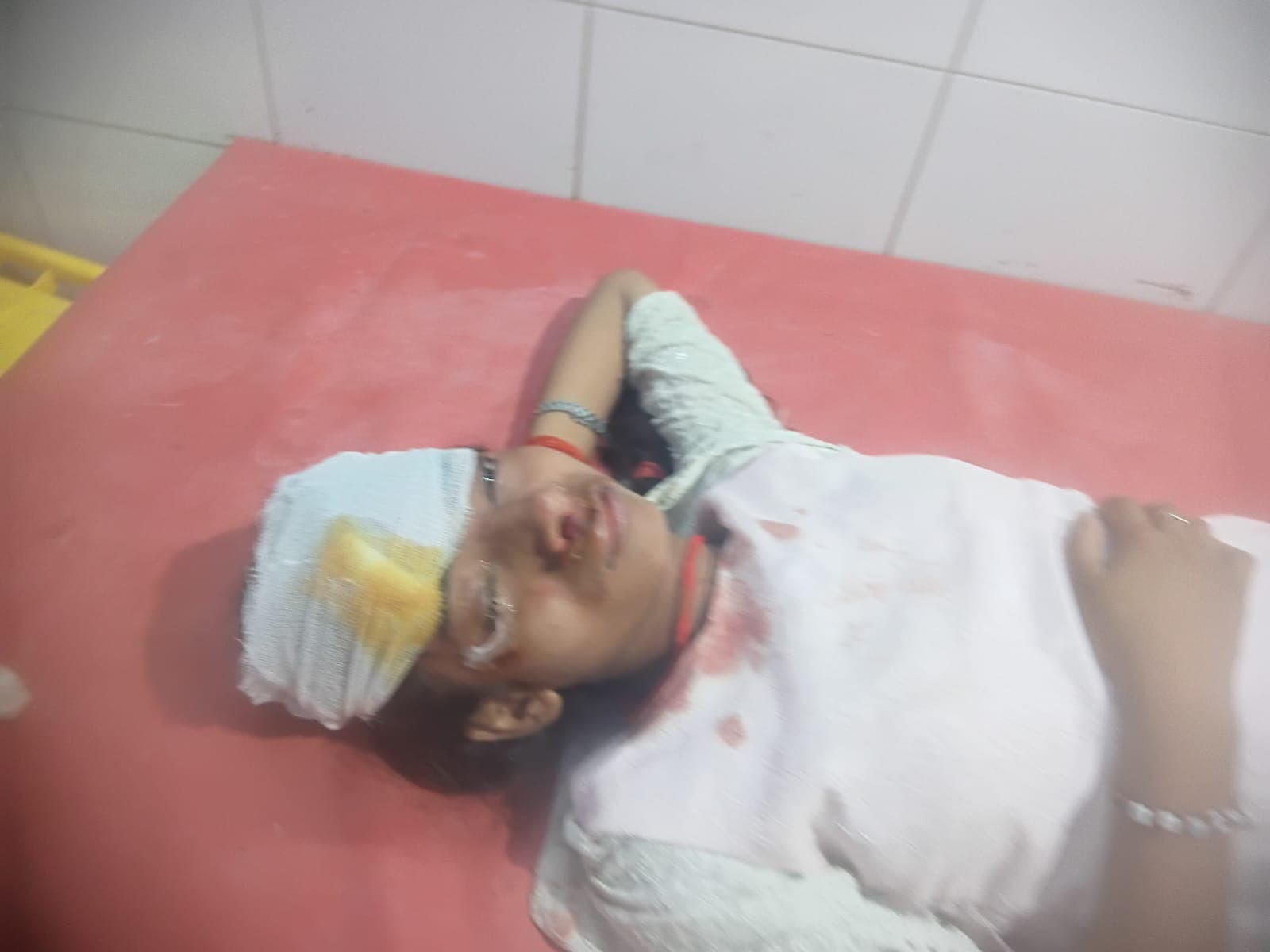 औरंगाबाद में कोचिंग जा रही छात्रा को ऑटो ने मारी टक्कर, ऑटो चालक फरार