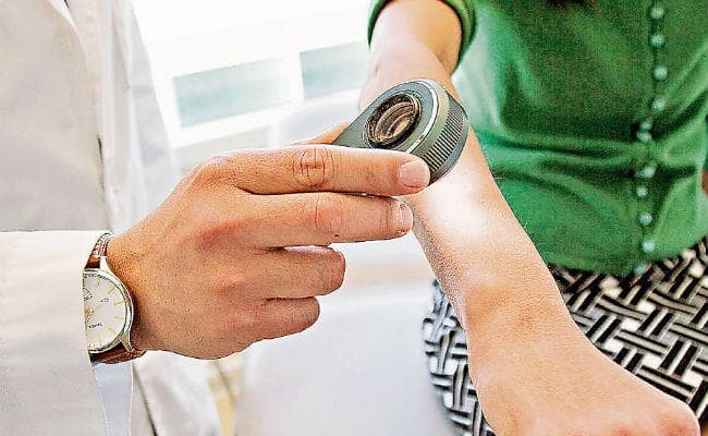 खुद पहचान पायेंगे स्किन कैंसर!