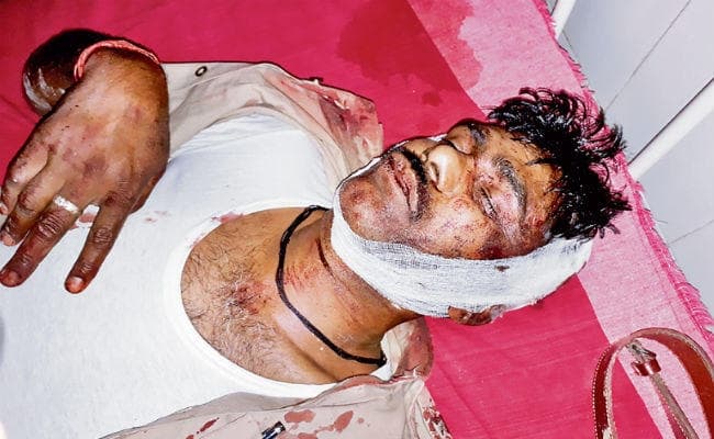 शराब माफियाओं के हमले में तीन पुलिसकर्मी घायल शराब माफियाओं के हमले में तीन पुलिसकर्मी घायल