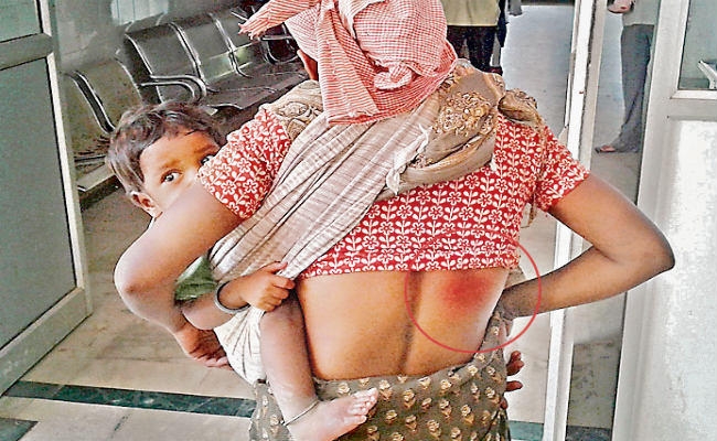 गुमला : खेत में शौच करने गयी थी आदिवासी महिला, खेत मालिक ने महिला के हाथ से फेंकवाया मैला