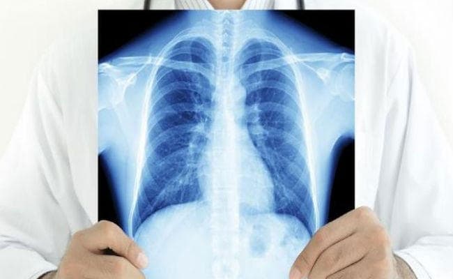 Health News: कीमोथेरेपी का दर्द कम कर सकता है यह हार्मोन…