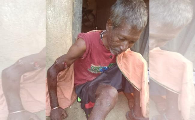 ODF जिला लातेहार में खुले में शौच करने गये कलेश्वर भगत को भालू ने नोचा, घायल