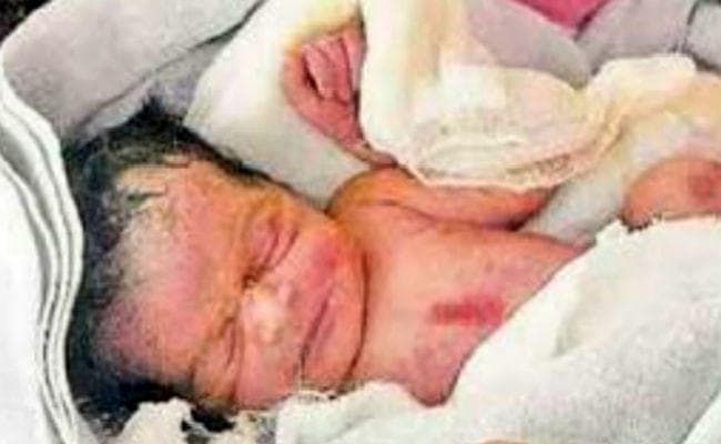 नर्स ने नवजात बच्ची को मृत समझ नाले में फेंका, दो घंटे तक नाले में तड़पती रही बच्ची, फिर…