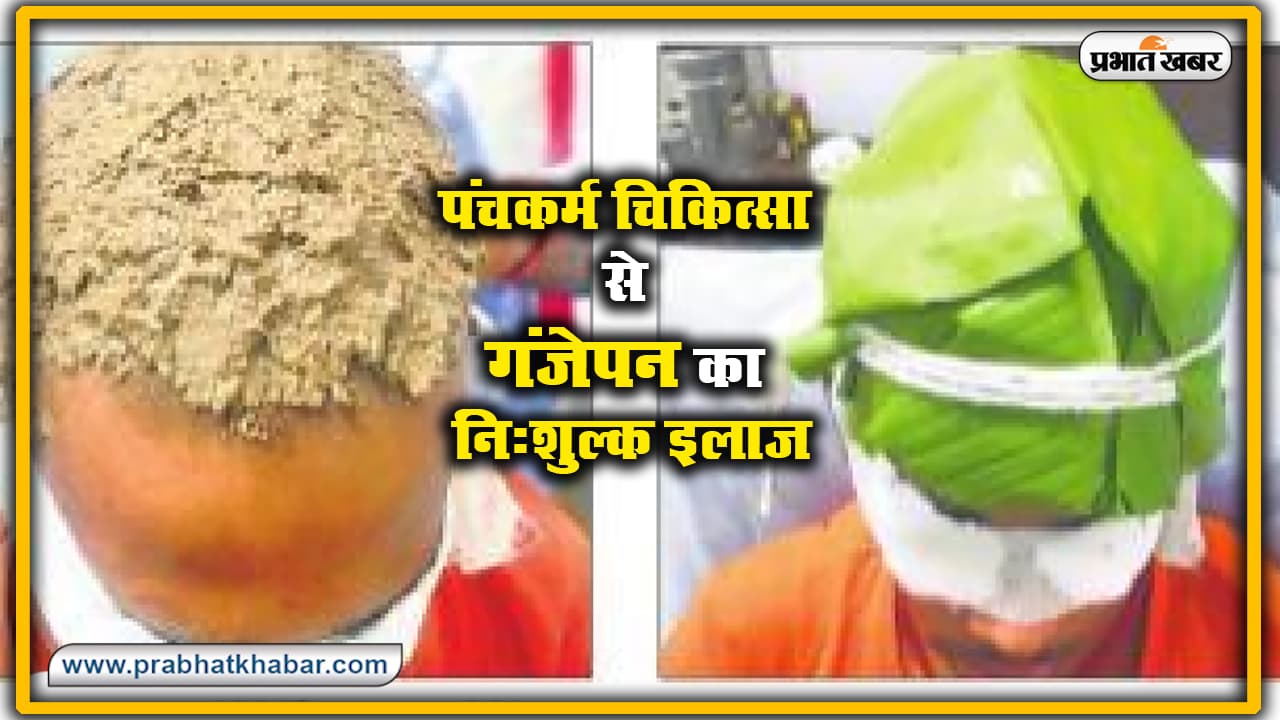 गंजेपन का मुफ्त इलाज कर रही बिहार की ये सरकारी आयुर्वेदिक अस्पताल, ढाई माह का है ट्रीटमेंट गंजेपन का मुफ्त इलाज कर रही बिहार की ये सरकारी आयुर्वेदिक अस्पताल, ढाई माह का है ट्रीटमेंट