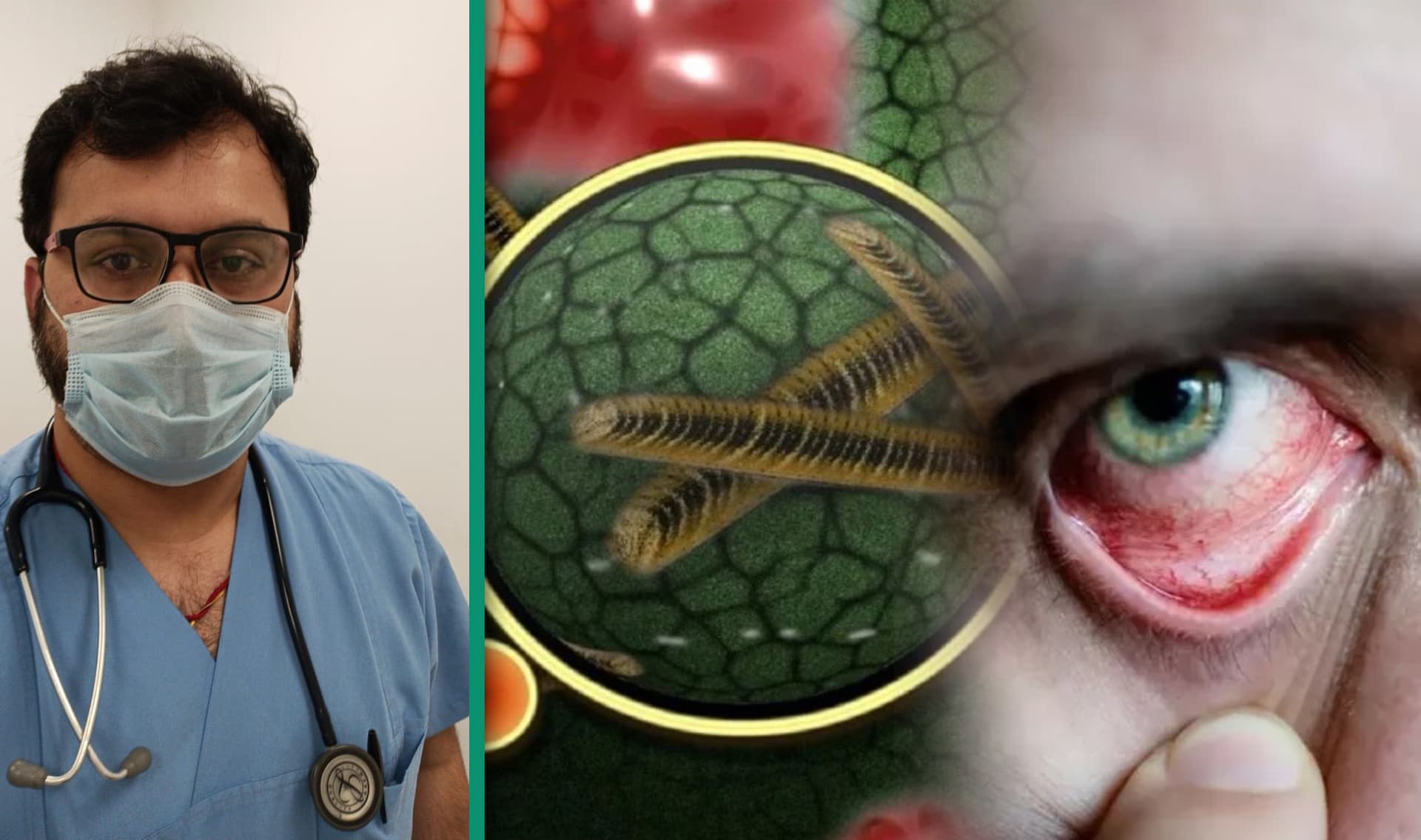 Black Fungus: क्यों इतना खतरनाक है ब्लैक फंगस, जानें इसके लक्षण व बचाव के उपाय, कैसे कोरोना मरीजों पर कर रहा अटैक, जानें सबकुछ एक्सपर्ट से Black Fungus: क्यों इतना खतरनाक है ब्लैक फंगस, जानें इसके लक्षण व बचाव के उपाय, कैसे कोरोना मरीजों पर कर रहा अटैक, जानें सबकुछ एक्सपर्ट से
