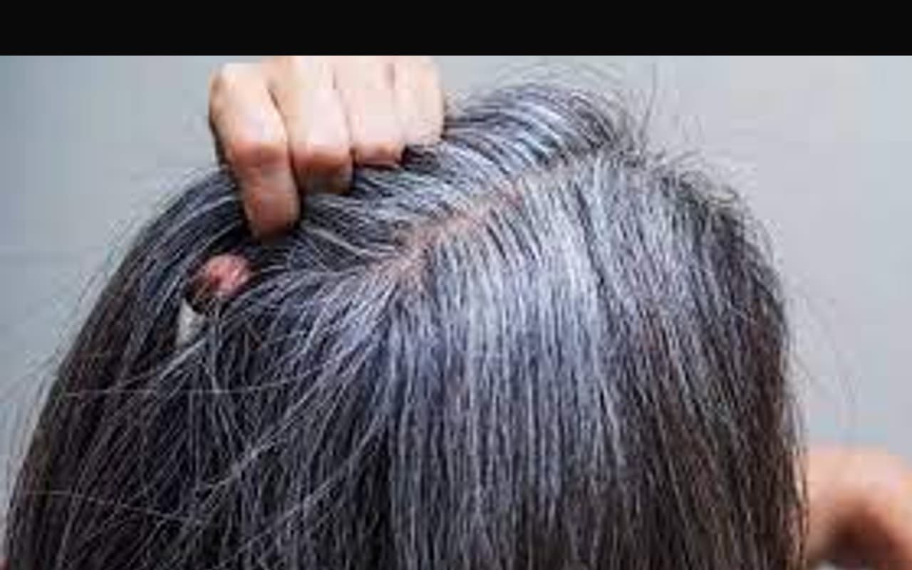 Hair Care Tips: असमय सफेद बालों की समस्या से हैं परेशान? आजमाएं ये आसान घरेलू नुस्खे Hair Care Tips: असमय सफेद बालों की समस्या से हैं परेशान? आजमाएं ये आसान घरेलू नुस्खे