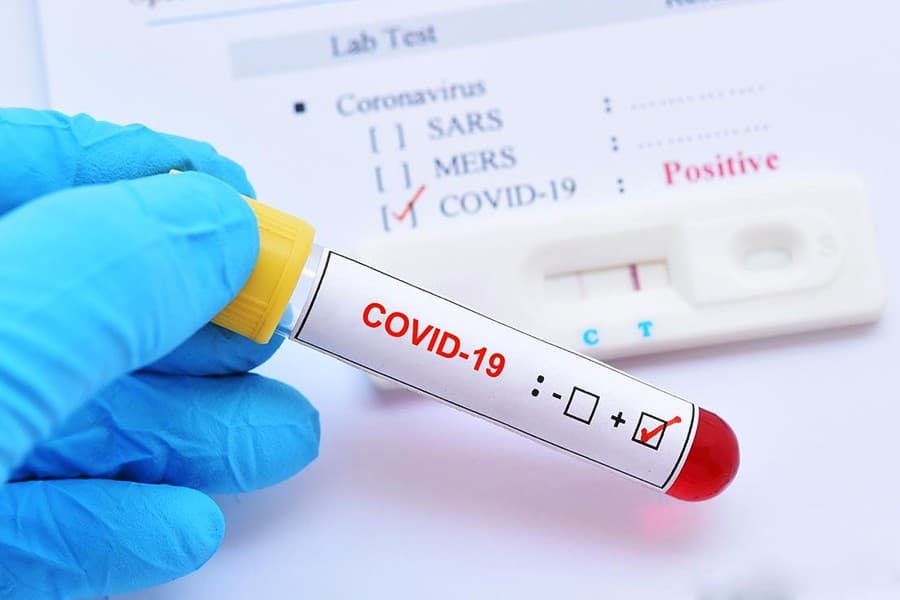 Covid 19 : एक काेरोना पॉजिटिव चाेर ने नाक में किया दम उसे पकड़नेवाले 29 पुलिसकर्मी अब कोरेंटिन में Covid 19 : एक काेरोना पॉजिटिव चाेर ने नाक में किया दम उसे पकड़नेवाले 29 पुलिसकर्मी अब कोरेंटिन में