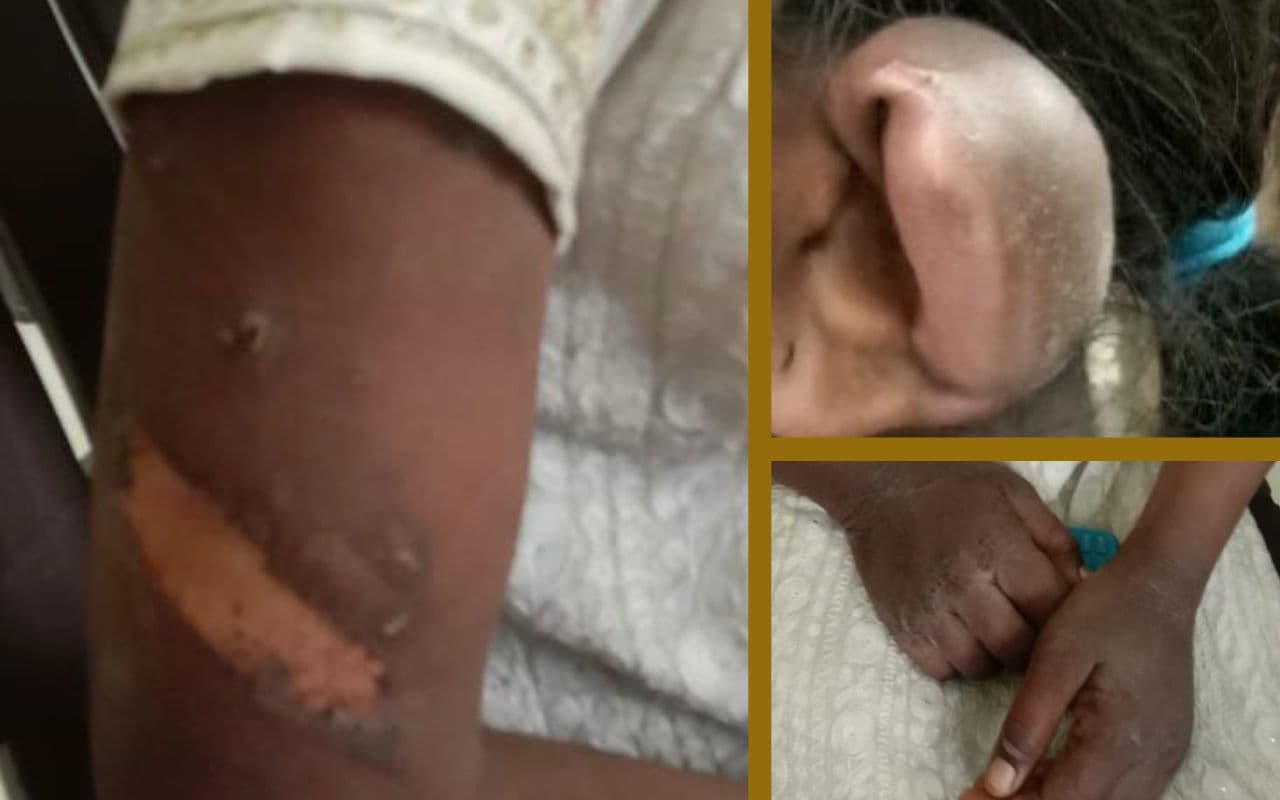 झारखंड की आदिवासी बच्ची पर गुरुग्राम में अमानवीय अत्याचार, सिमडेगा से कल हरियाणा जायेगी टीम झारखंड की आदिवासी बच्ची पर गुरुग्राम में अमानवीय अत्याचार, सिमडेगा से कल हरियाणा जायेगी टीम