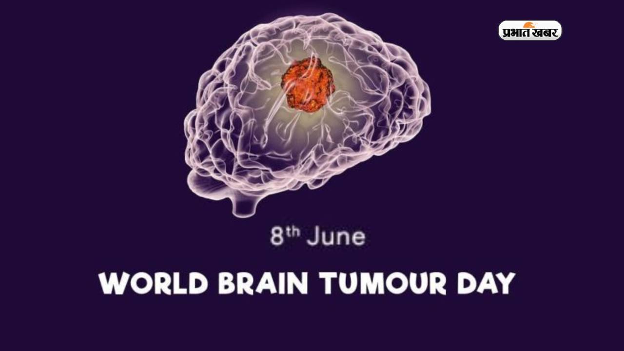 World Brain Tumor Day 2023: आज मनाया जा रहा है वर्ल्ड ब्रेन ट्यूमर डे, जानें कैसे करें इसकी पहचान World Brain Tumor Day 2023: आज मनाया जा रहा है वर्ल्ड ब्रेन ट्यूमर डे, जानें कैसे करें इसकी पहचान