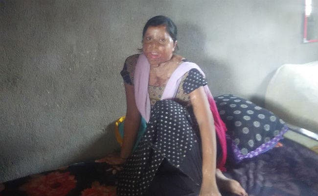 नहीं रही एसिड अटैक पीड़िताओं को न्याय दिलाने वाली बिहार की बेटी: पढें विशेष लेख- अभी तुम्हारी जरूरत थी चंचल नहीं रही एसिड अटैक पीड़िताओं को न्याय दिलाने वाली बिहार की बेटी: पढें विशेष लेख- अभी तुम्हारी जरूरत थी चंचल
