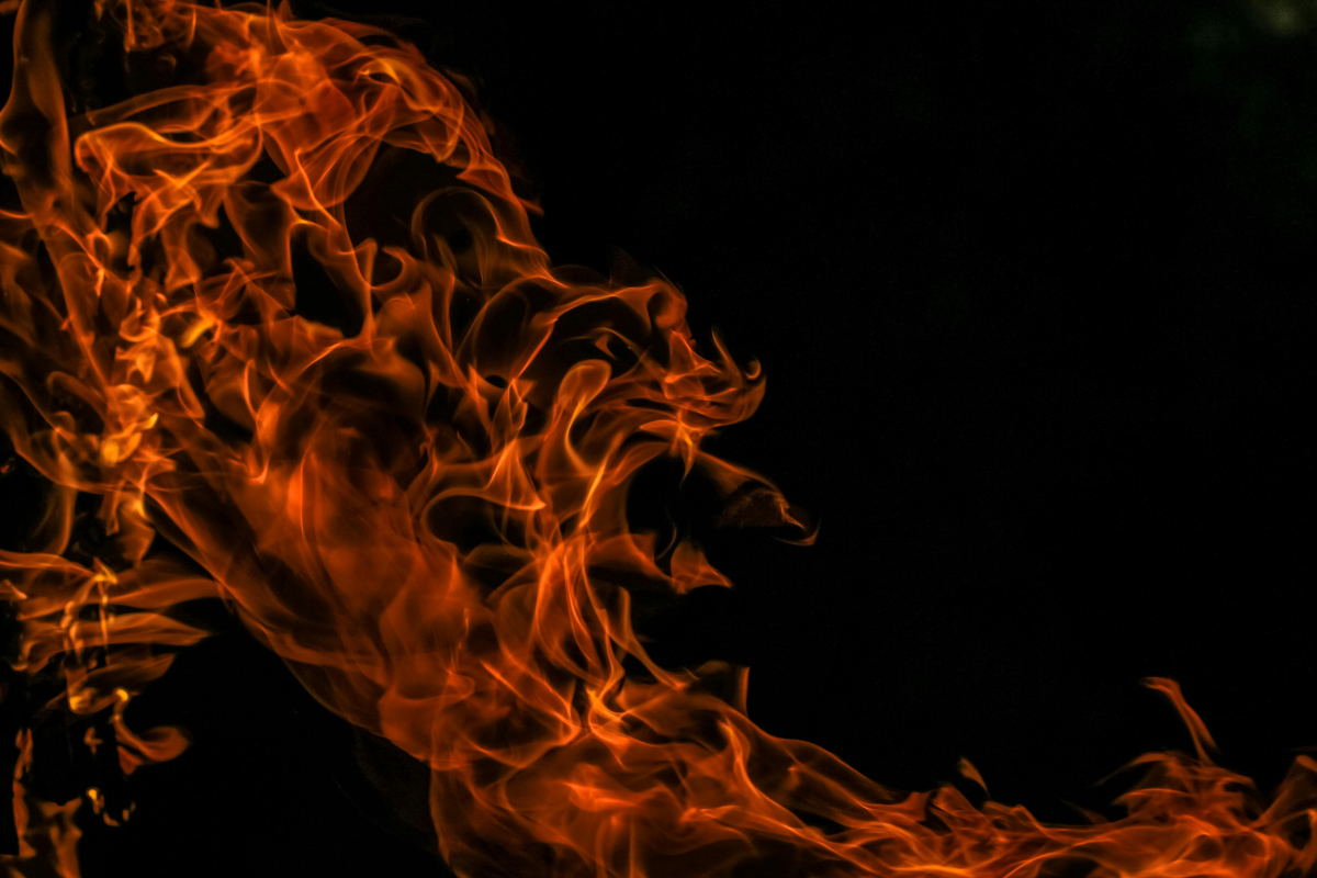 Burn Marks Remedy: जलने के निशान से पाना है छुटकारा, आजमाएं ये घरेलु नुस्खे