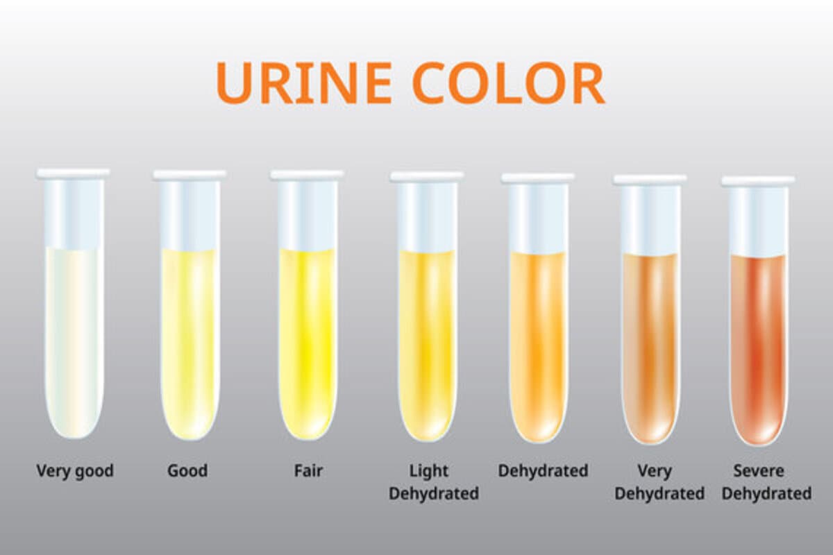 what is your urine color what is your urine color