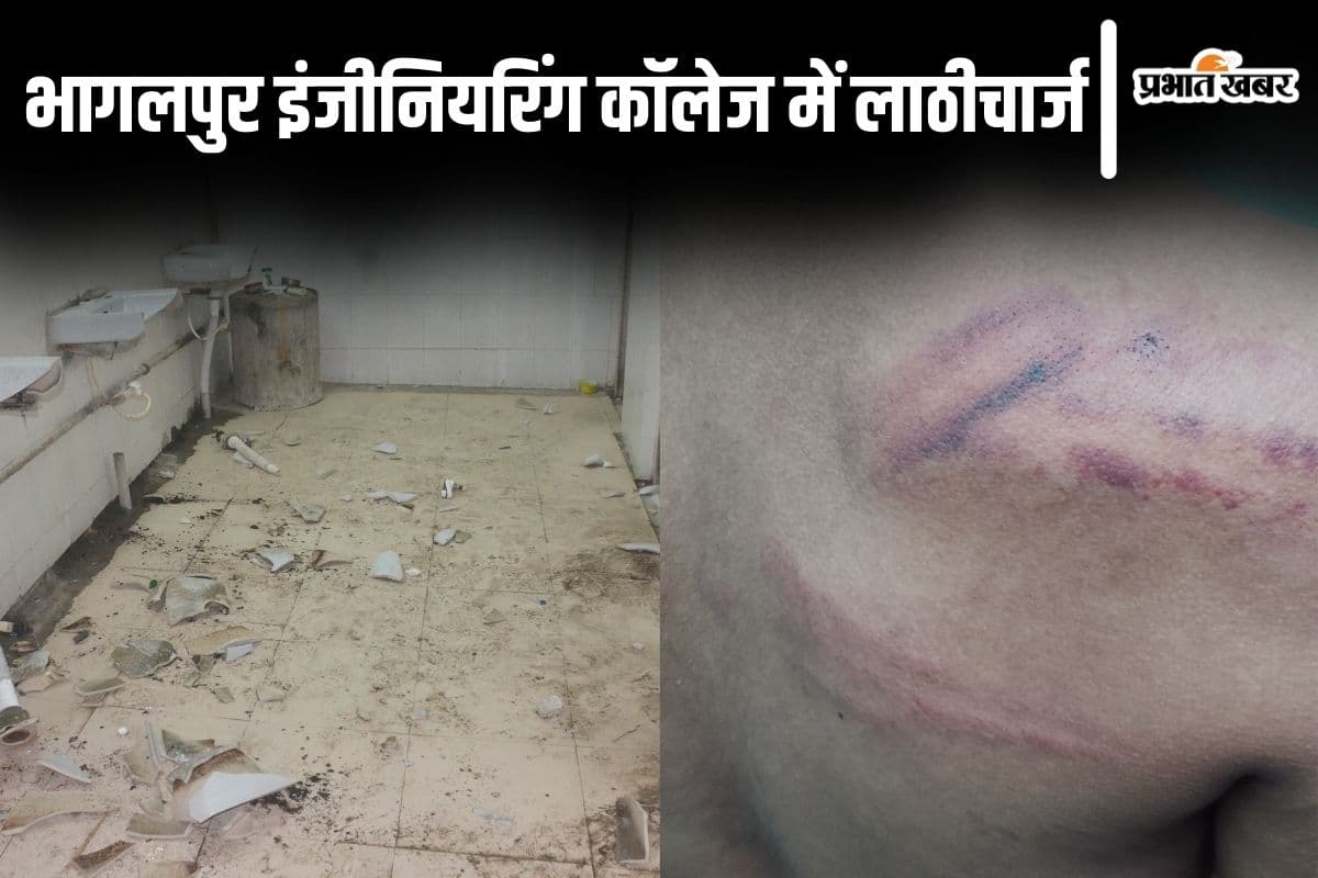 Photos: ‘हमें ऐसे पीटा मानो आतंकवादी हैं’, भागलपुर इंजीनियरिंग कॉलेज के हॉस्टल में पुलिस का रौद्र रूप दिखा