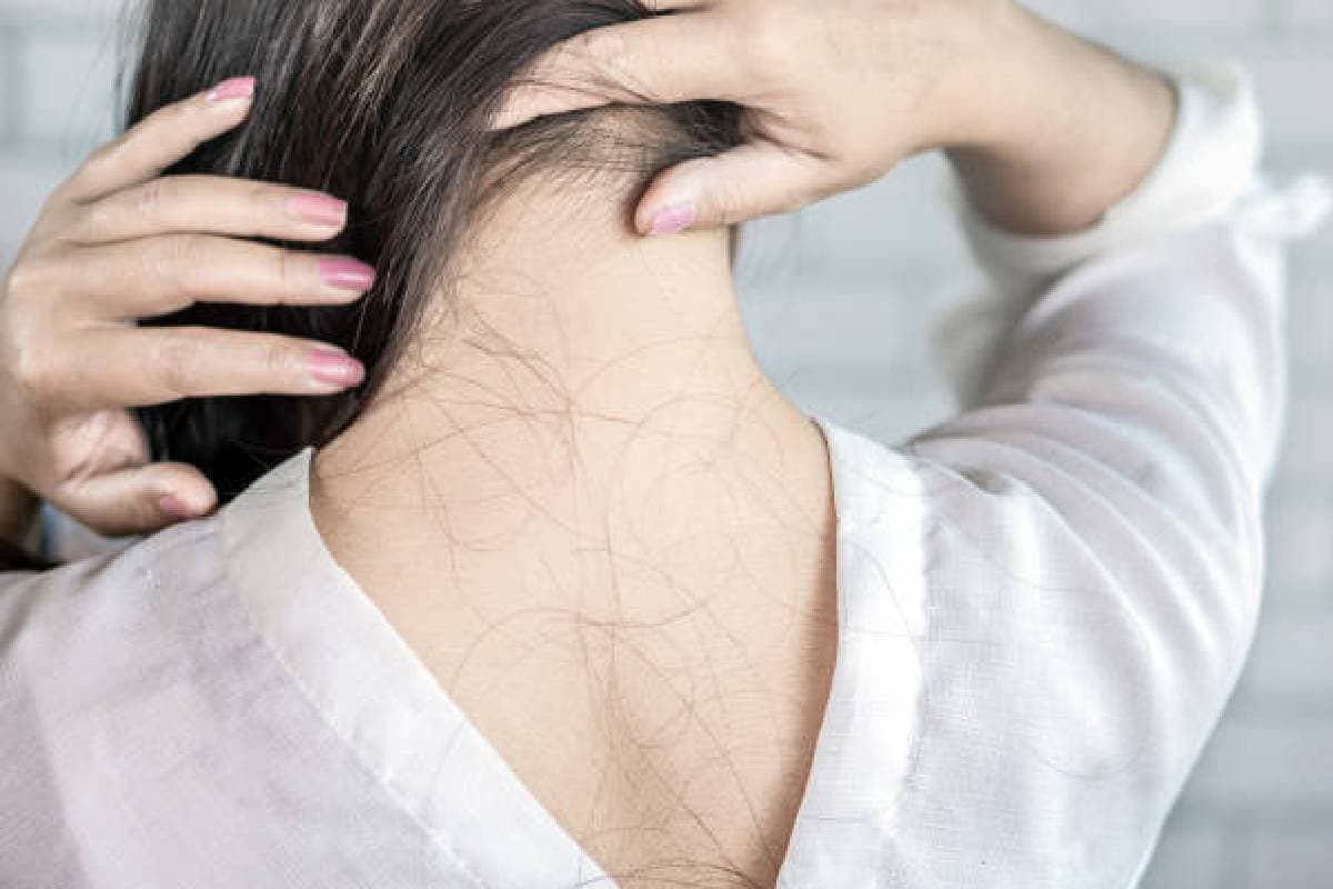 Hairfall Hairfall