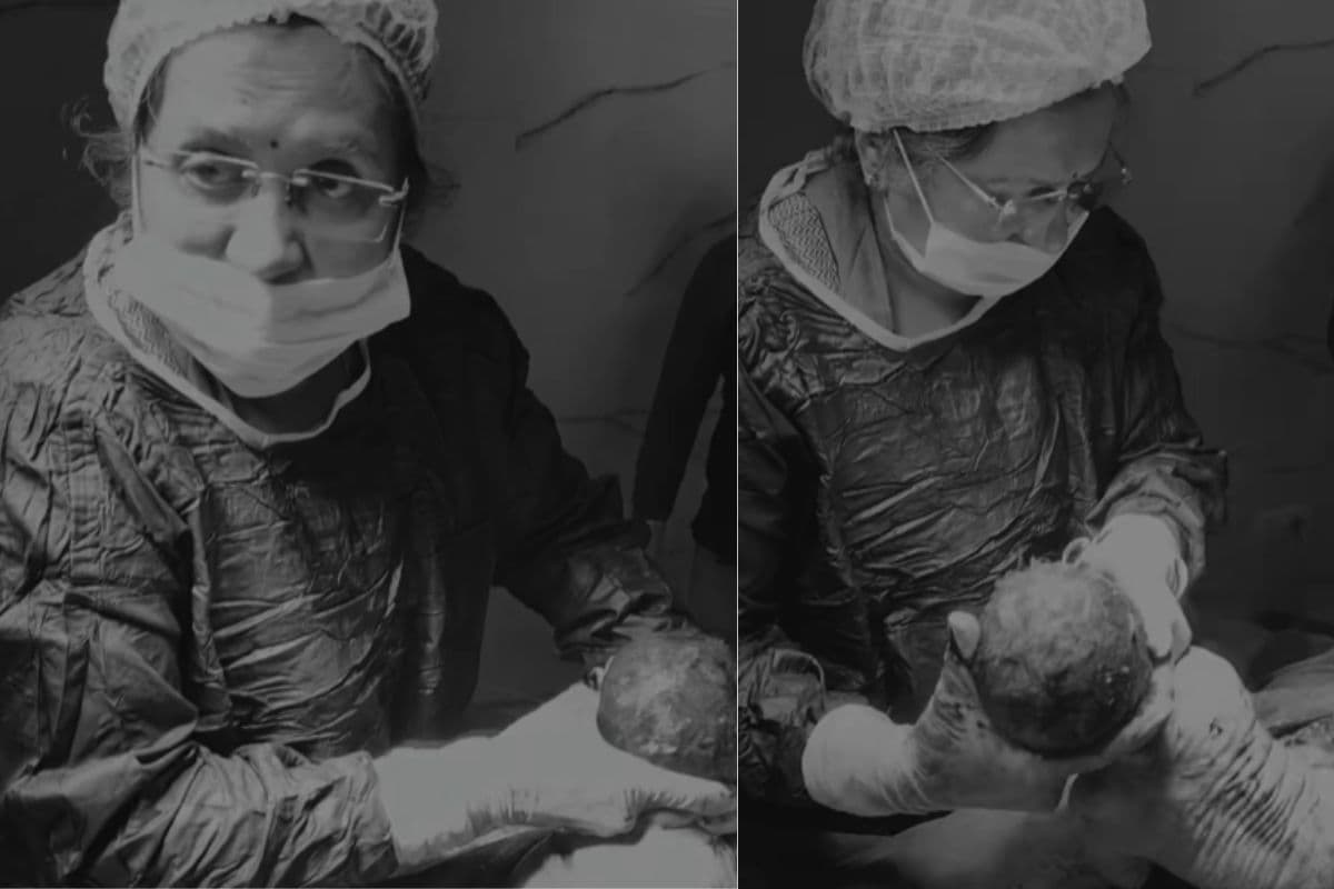 Watch video of pregnant woman giving birth to a baby through operation Watch video of pregnant woman giving birth to a baby through operation